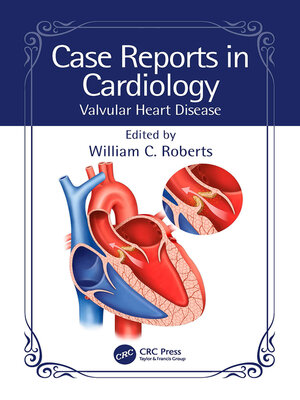cover image of Valvular Heart Disease